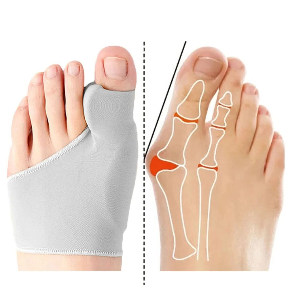 Ankle Brace Sock - 1/2 쌍 발가락 분리기 Hallux Valgus
